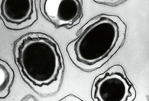 Rare anthrax case diagnosed in Minnesota