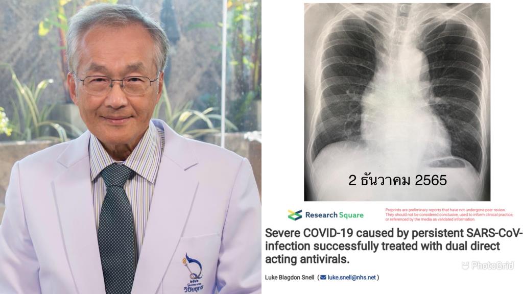 ‘Dr Manoon’ warns COVID may cause pneumonia to recur in people who’ve had lymphoma