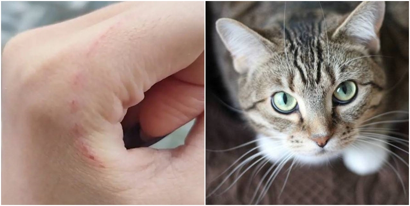 Man in China Puts Himself at Risk After Trying to Suck Girlfriend’s Stray Cat Wound