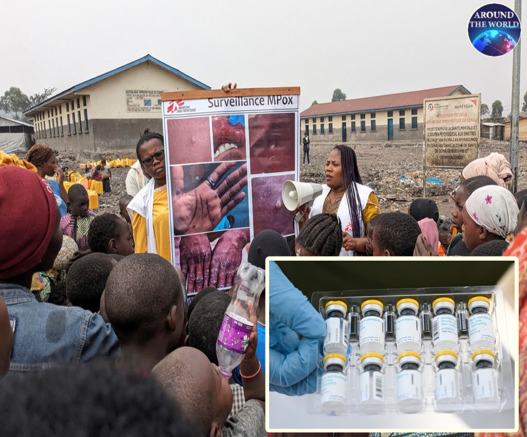 Monkeypox Vaccine Breakthrough: Global Alliance Unleashes 500,000 Doses to Africa in Historic First